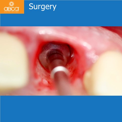 Extraction, Augma and Implants
