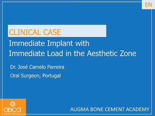 Immediate Implant with Immediate Load in the Aesthetic Zone