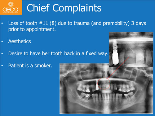 Immediate Implant with Immediate Load in the Aesthetic Zone