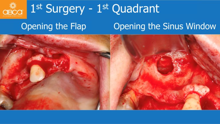 Clinical Case