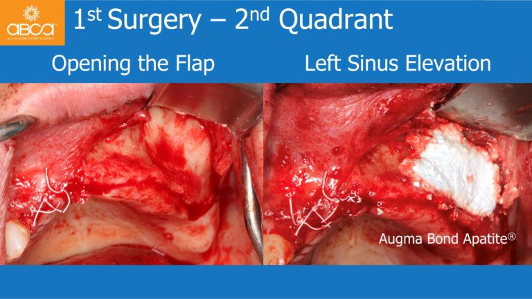 Clinical Case