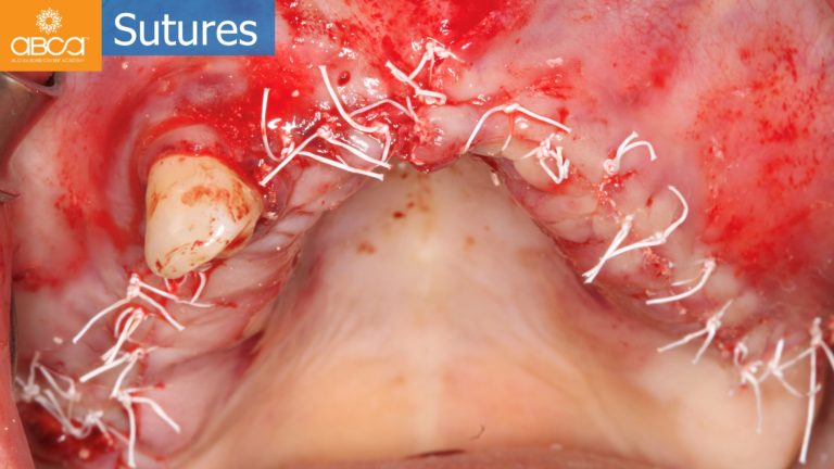 Clinical Case