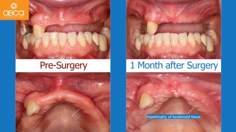 Clinical Case