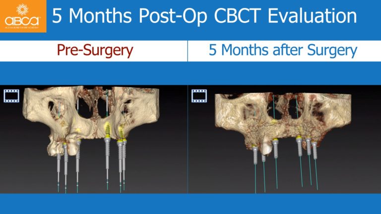 Clinical Case