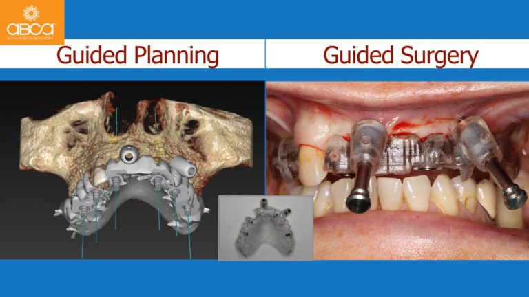 Clinical Case