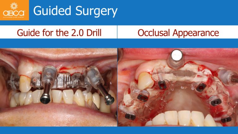 Clinical Case