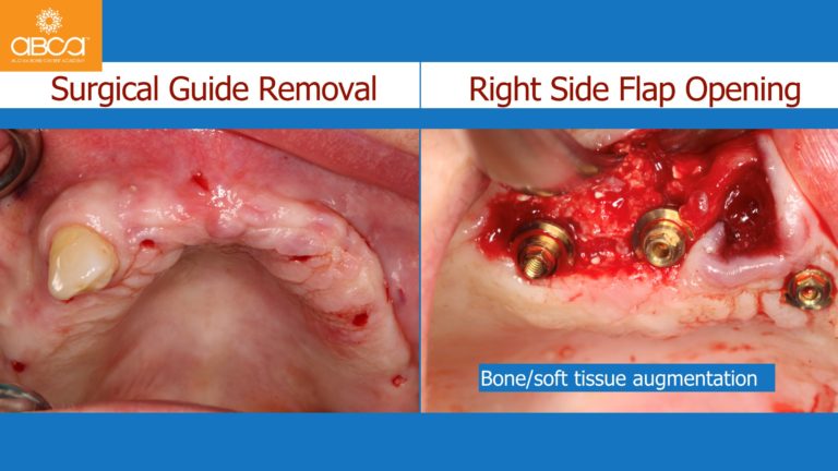 Clinical Case