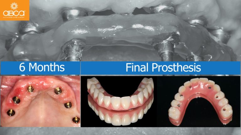 Clinical Case