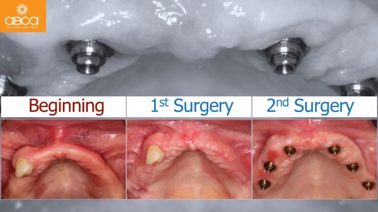 Clinical Case