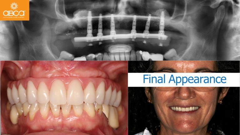 Clinical Case