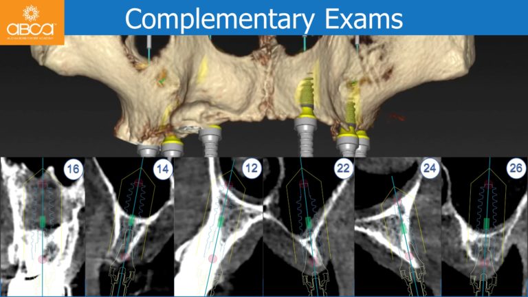 Clinical Case