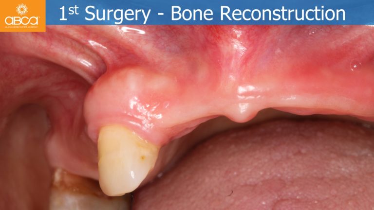 Clinical Case