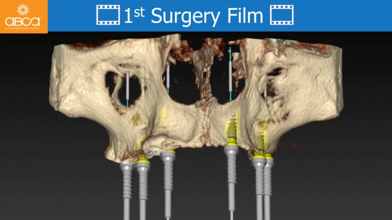 Clinical Case