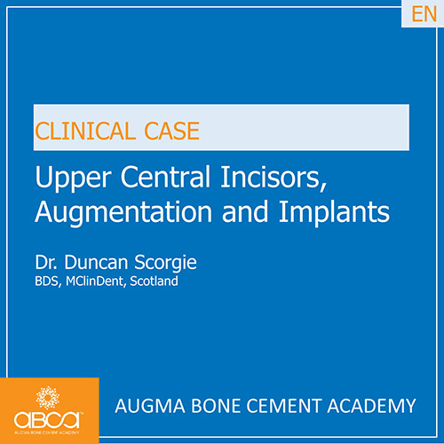 Upper Central Incisors, Augmentation and Implants