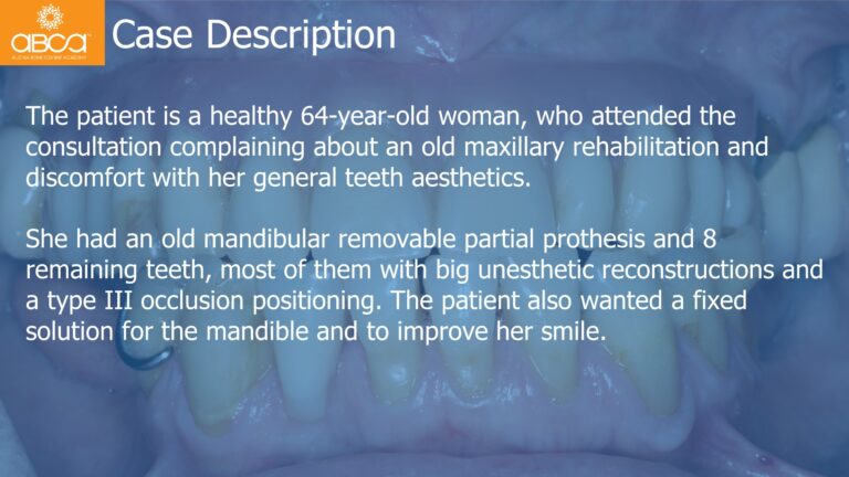 Mandible Full Arch Rehabilitation with an Immediate All-on-5 and Immediate Load