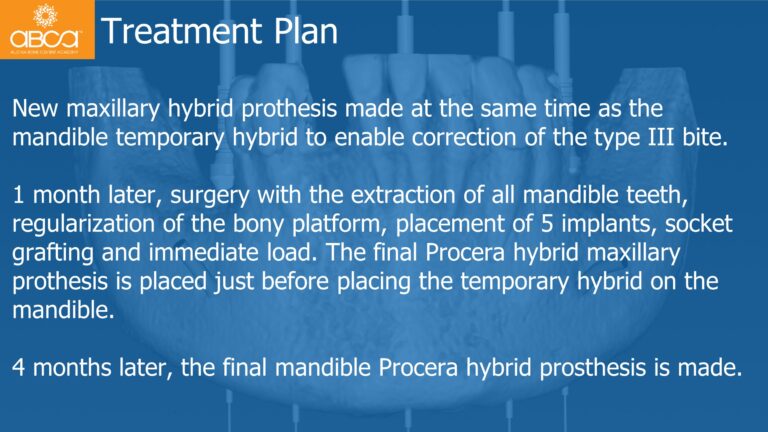 Mandible Full Arch Rehabilitation with an Immediate All-on-5 and Immediate Load