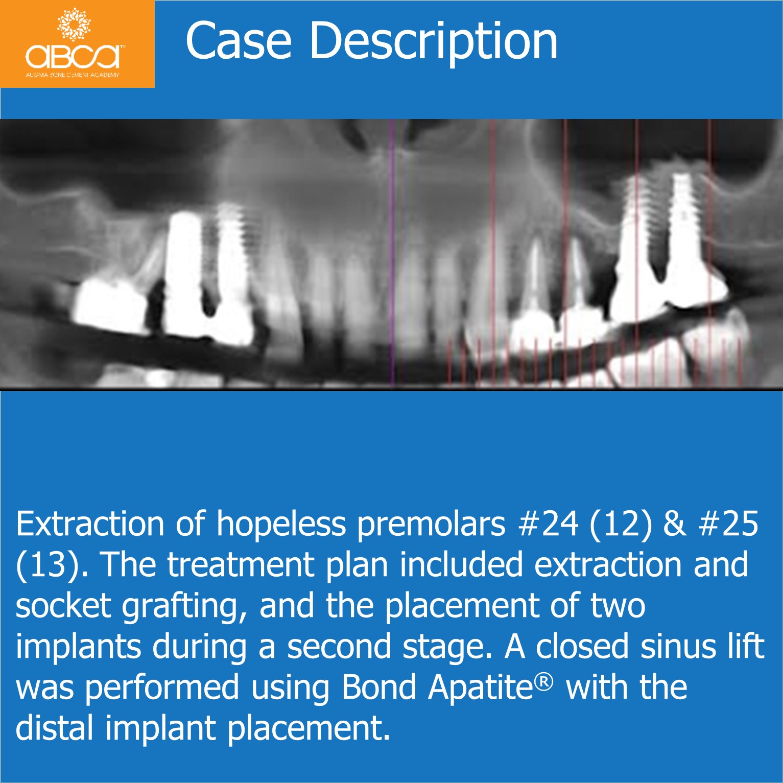 Case Description