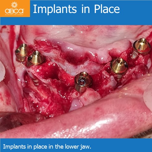 Clinical Case