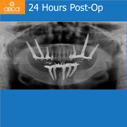 Clinical Case