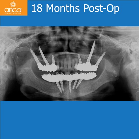 Clinical Case