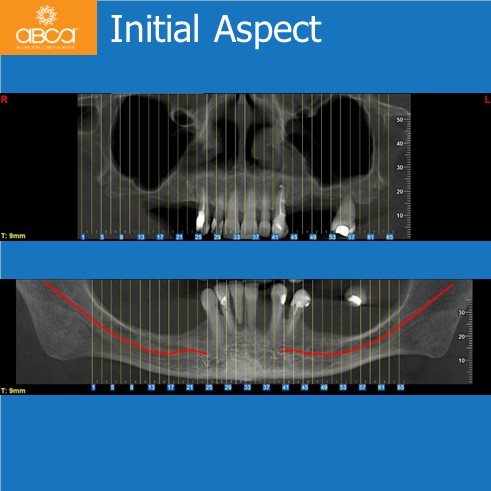 Clinical Case