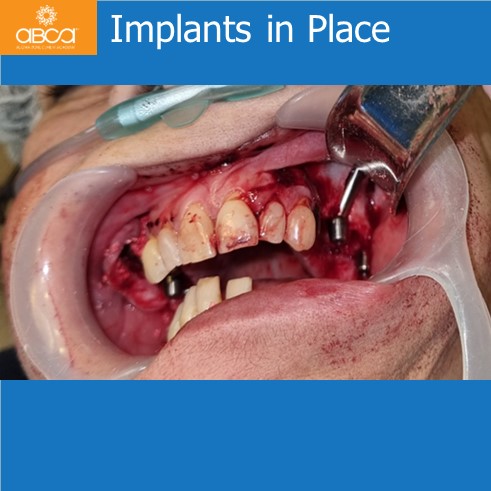 Clinical Case