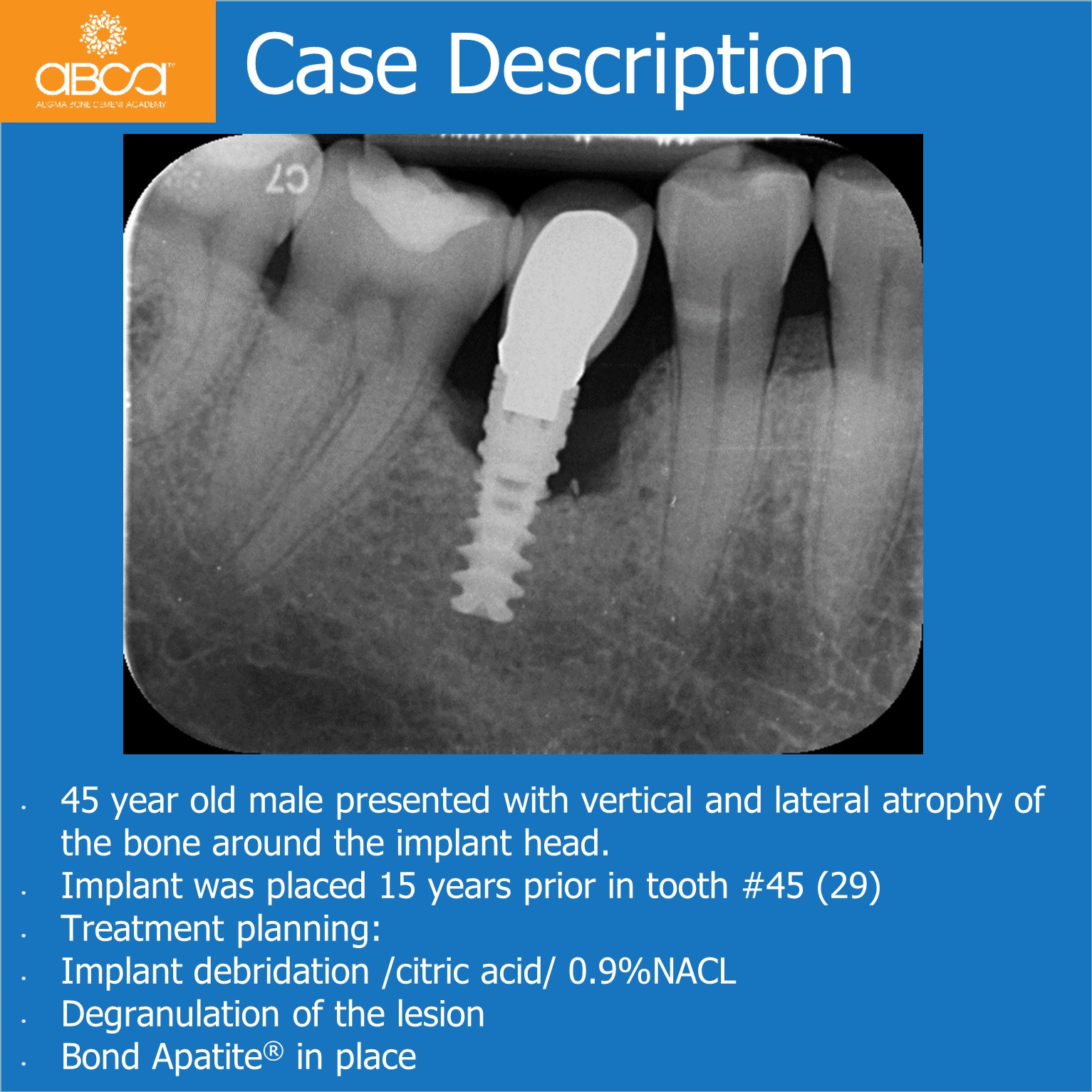 Case Description