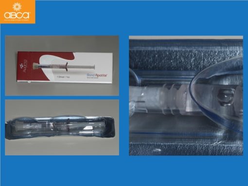 Zygomatic Implants & Bond Apatite Grafting