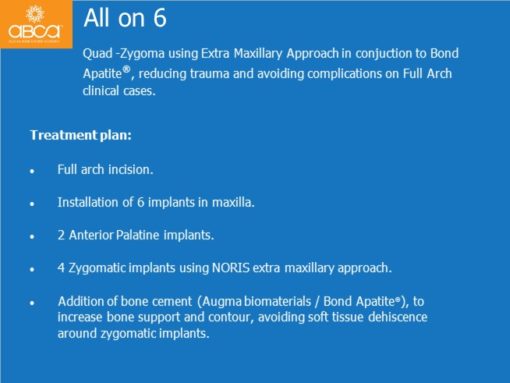 Zygomatic Implants & Bond Apatite Grafting