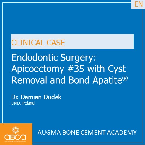 Endodontic Surgery: Apicoectomy #35 with Cyst Removal and Bond Apatite