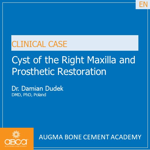 Cyst of the Right Maxilla and Prosthetic Restoration