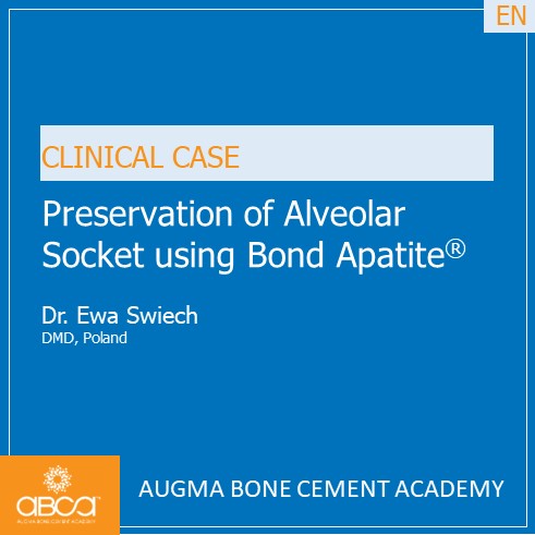 Preservation of Alveolar Socket using Bond Apatite