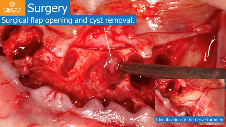 Clinical Case