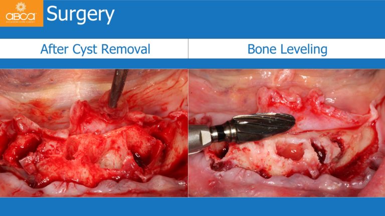 Clinical Case