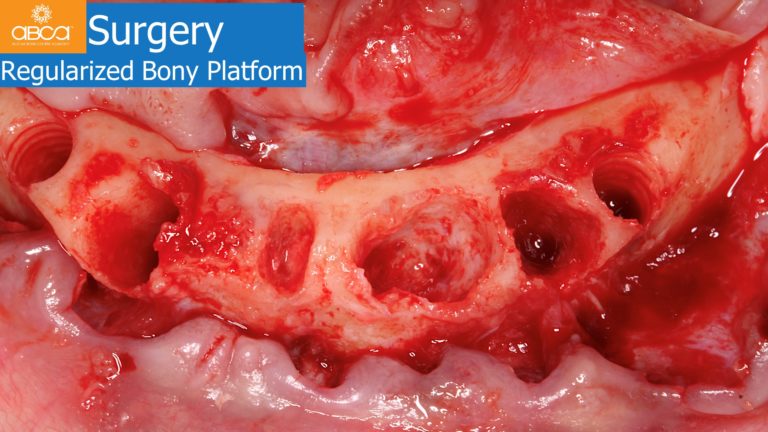 Clinical Case