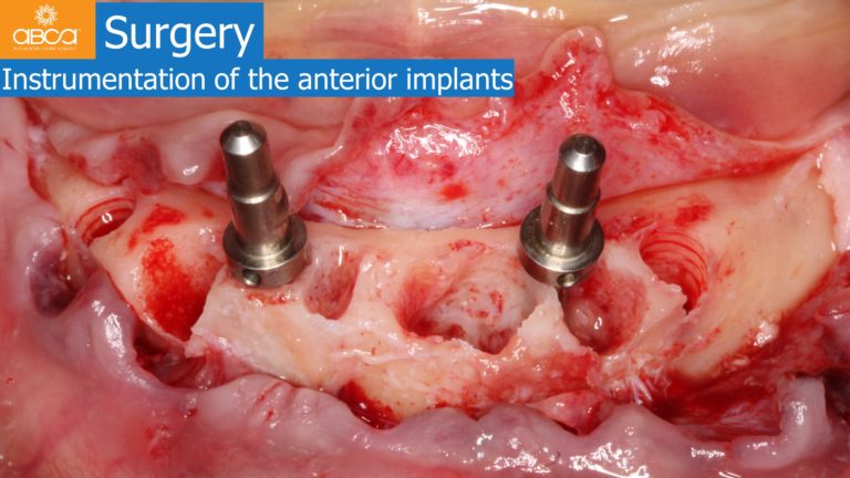 Clinical Case