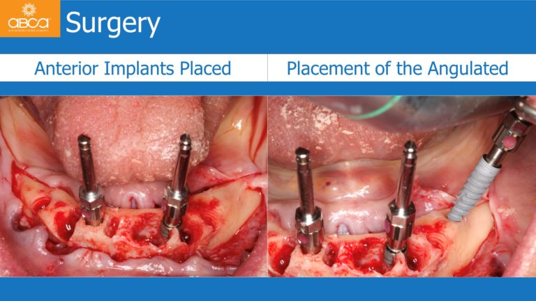 Clinical Case