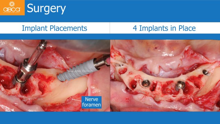 Clinical Case