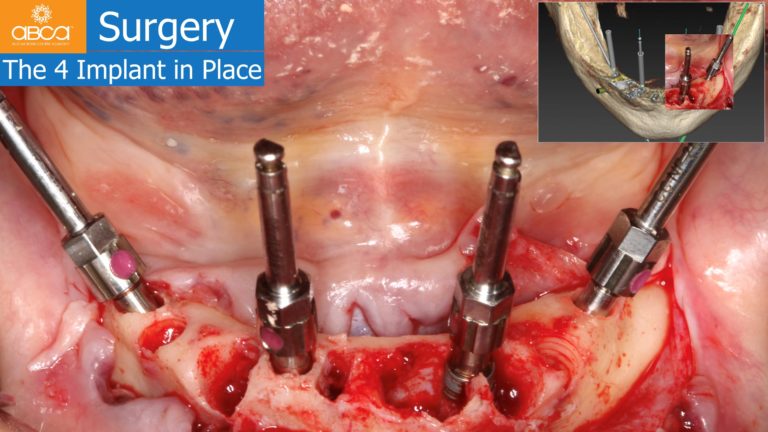 Clinical Case