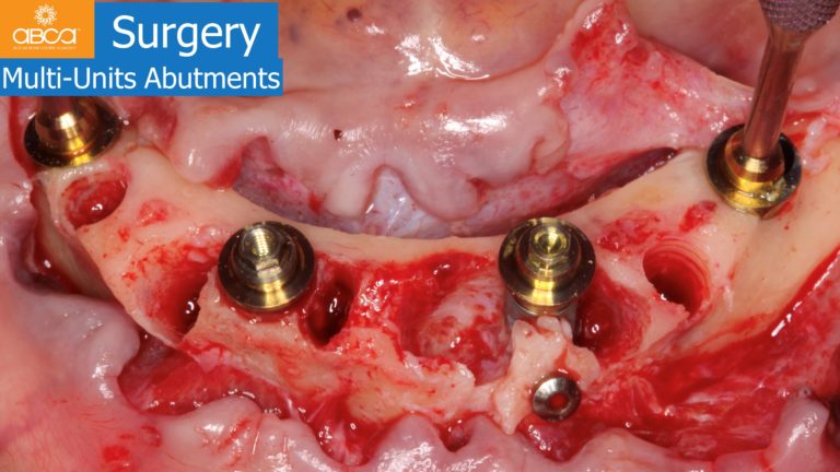 Clinical Case