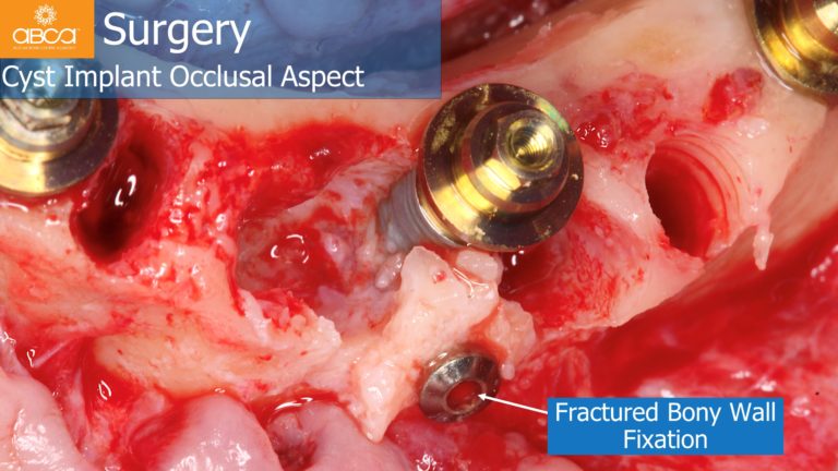 Clinical Case