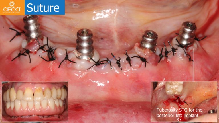 Clinical Case