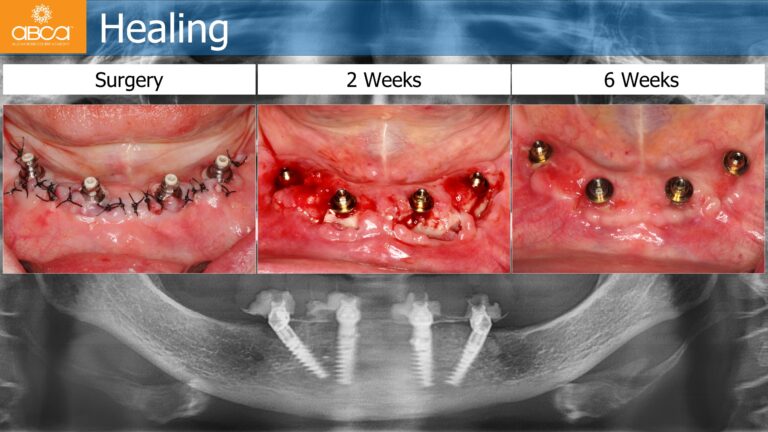 Clinical Case