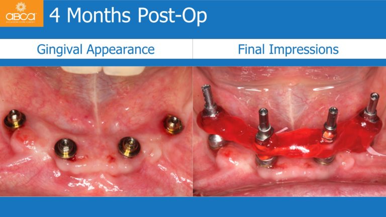 Clinical Case