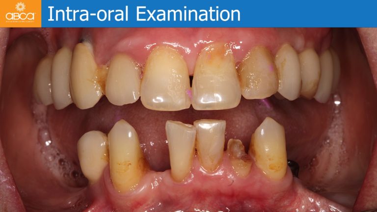 Clinical Case