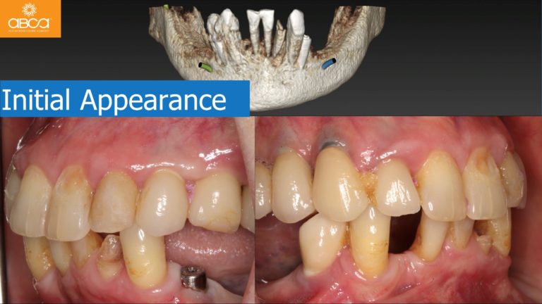 Clinical Case