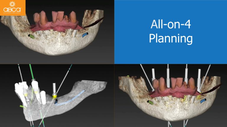 Clinical Case