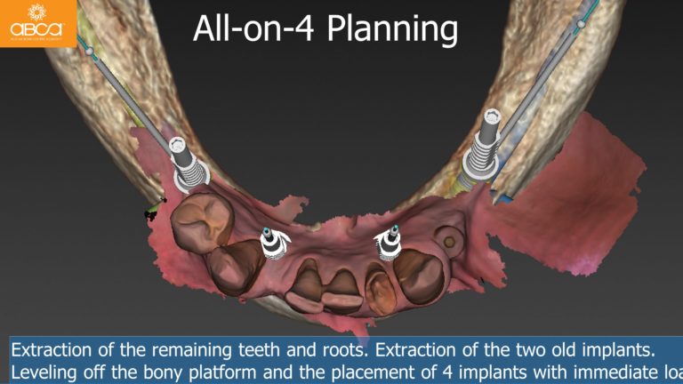 Clinical Case