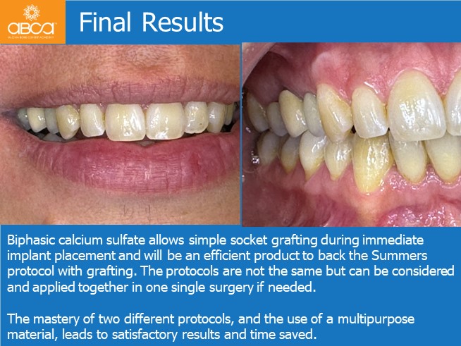 Immediate Loading in an Atrophied Maxilla