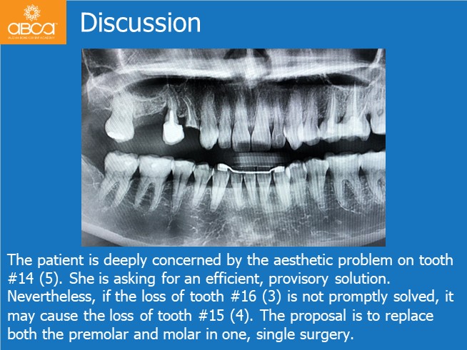 Immediate Loading in an Atrophied Maxilla